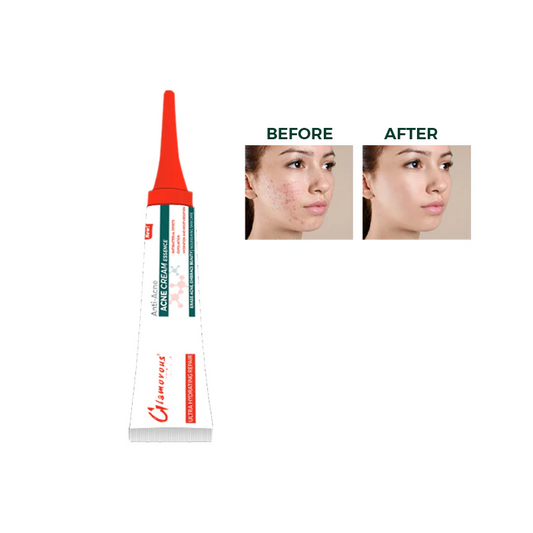 GLAMOROUS ANTI ACNE CREAM ESSENCE GF-1108