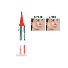 GLAMOROUS ANTI ACNE CREAM ESSENCE GF-1108