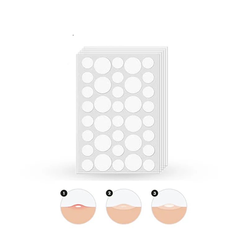 GLAMOROUS ACNE PIMPLE PATCH